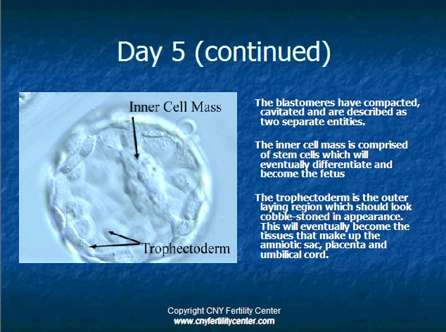 Day 5 embryos