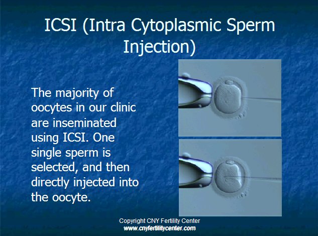 Isci explanatory image