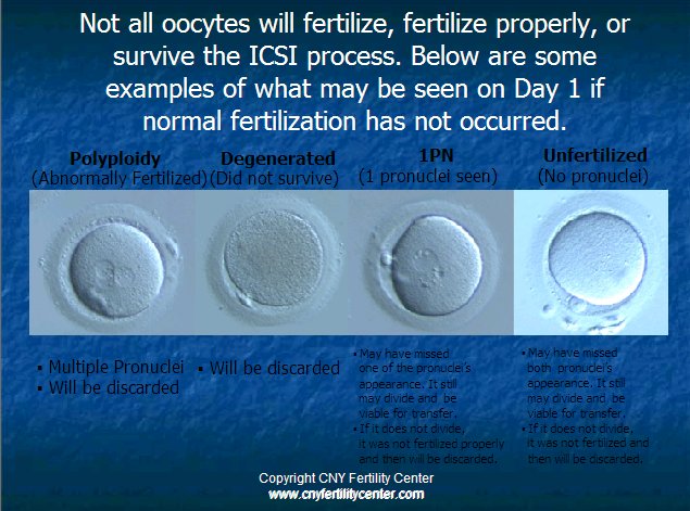 Oocyte chart