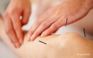 Acupuncture for Fertility