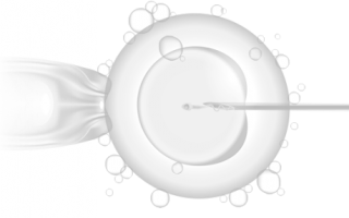 The IVF Funnel: Rates of Attrition in the IVF Process