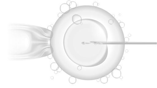 The IVF Funnel: Rates of Attrition in the IVF Process