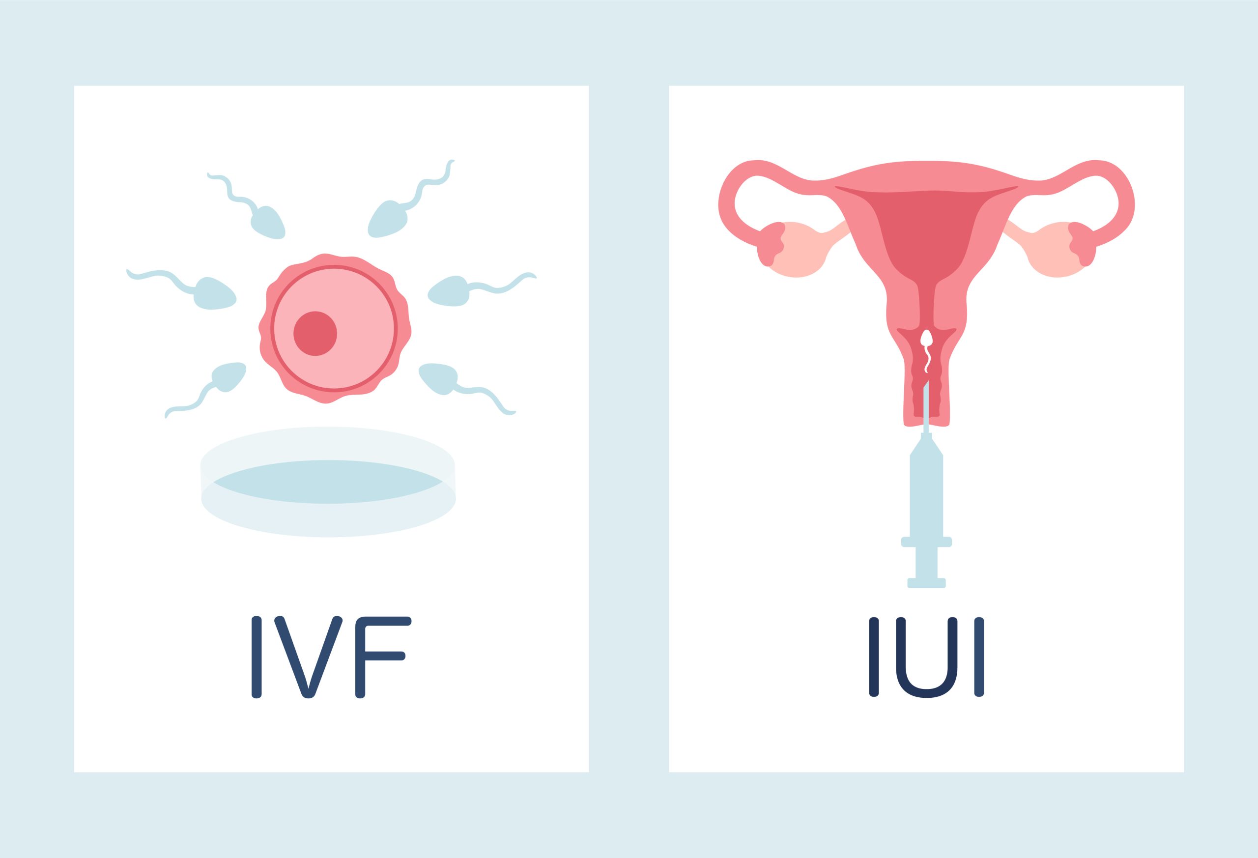 IUI vs IVF Price: Comparing the Costs and Benefits