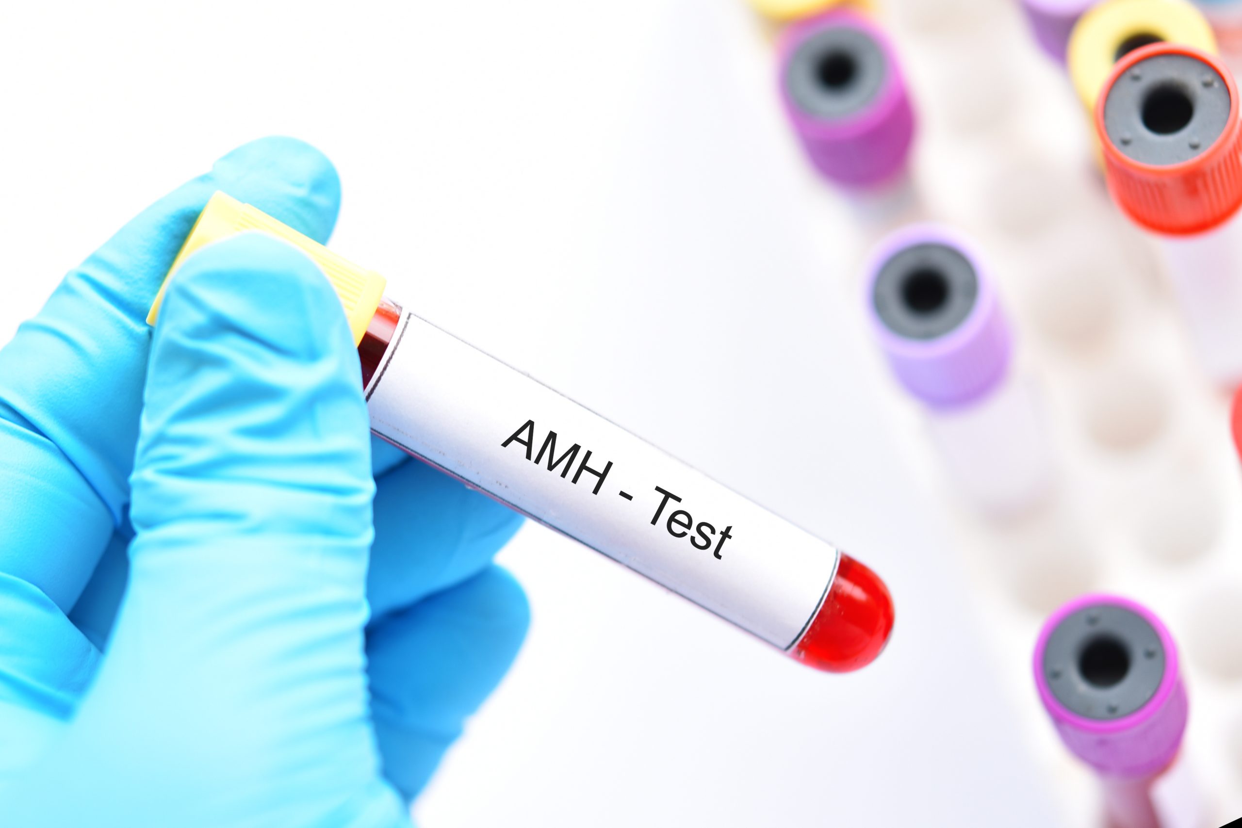 IVF With Low AMH: Impacts and Protocols