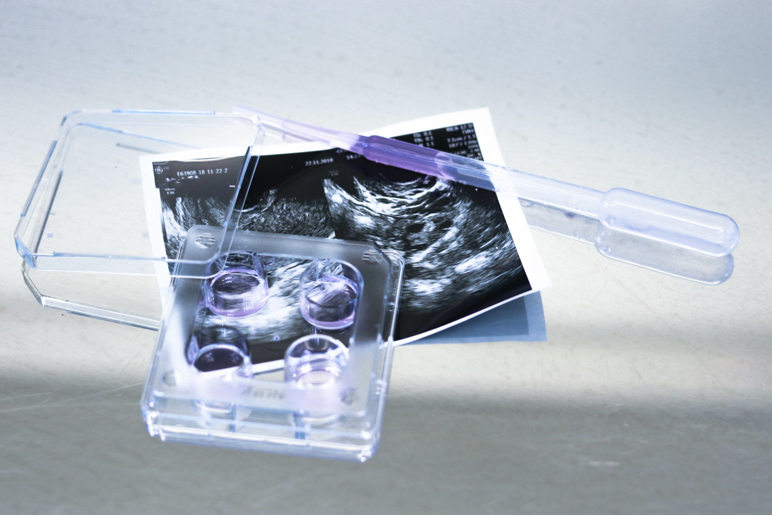 Natural (Ovulatory) Frozen Embryo Transfer: How It Works