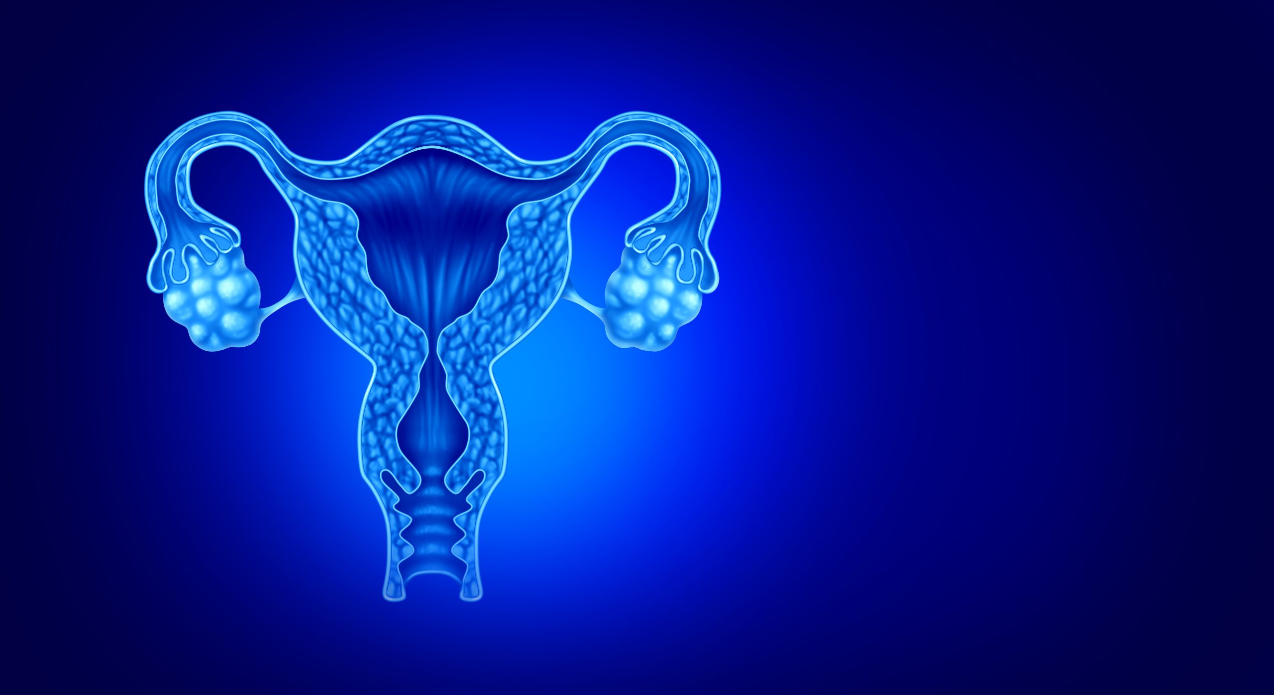 IVF with Endometriosis: Everything You Need to Know