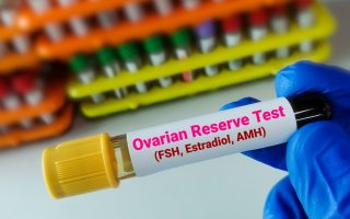 Best Protocols for Poor Ovarian Reserve: What You Need to Know