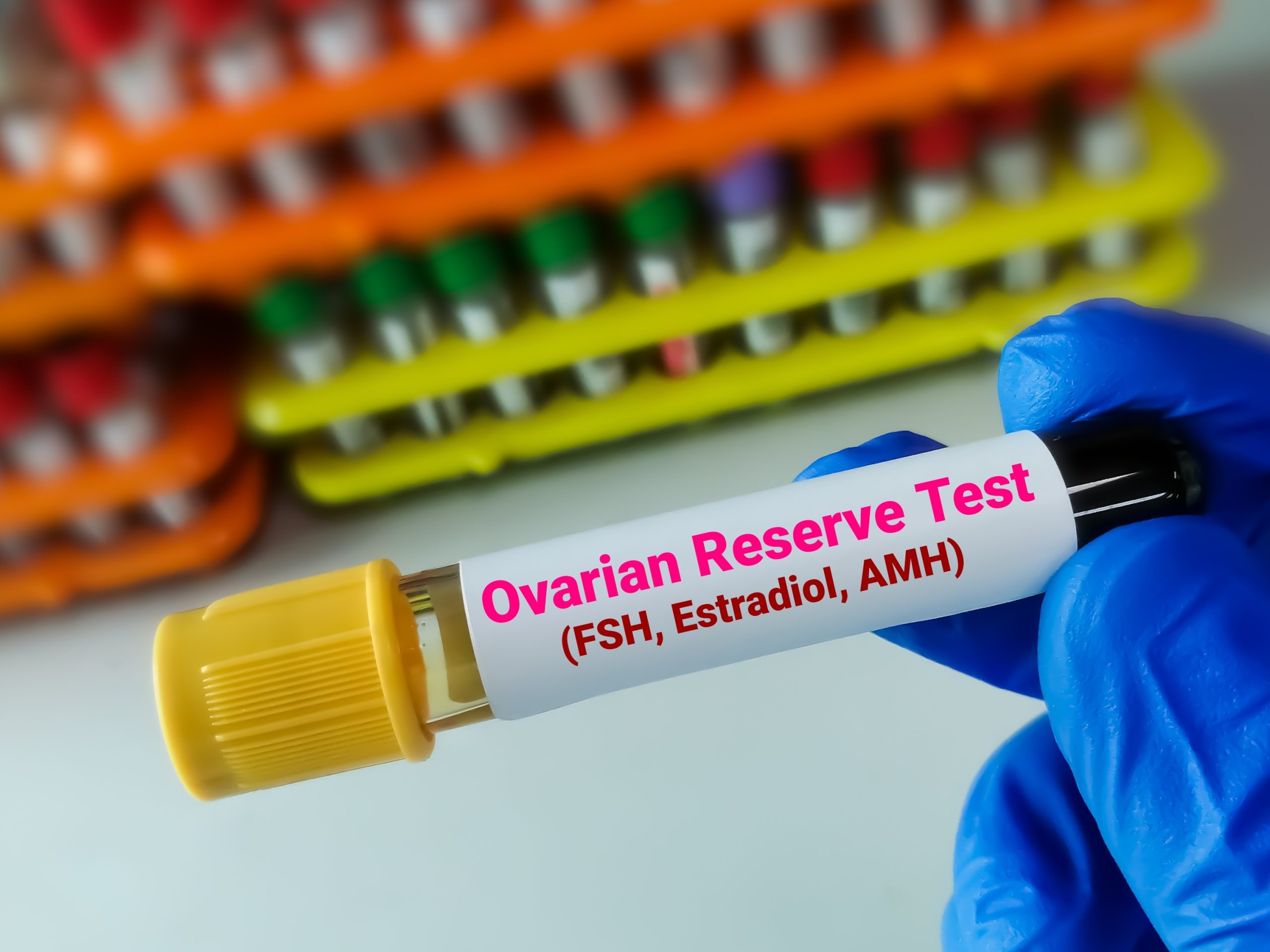 Best Protocols for Poor Ovarian Reserve: What You Need to Know