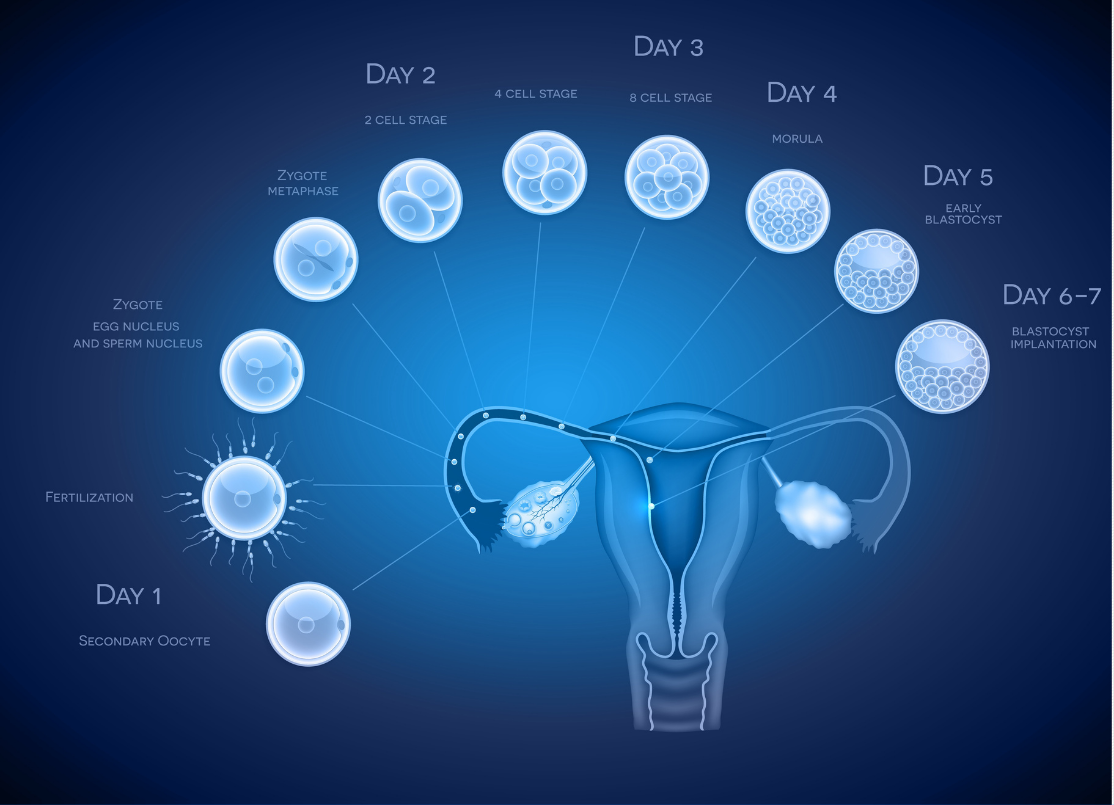 Day 3 V s Day 5 Embryo Transfer