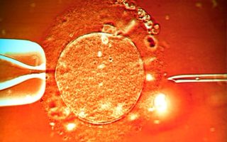 IVF After Tubal Ligation