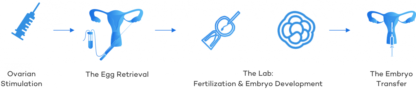 The Ivf Process Everything You Need To Know Cny Fertility