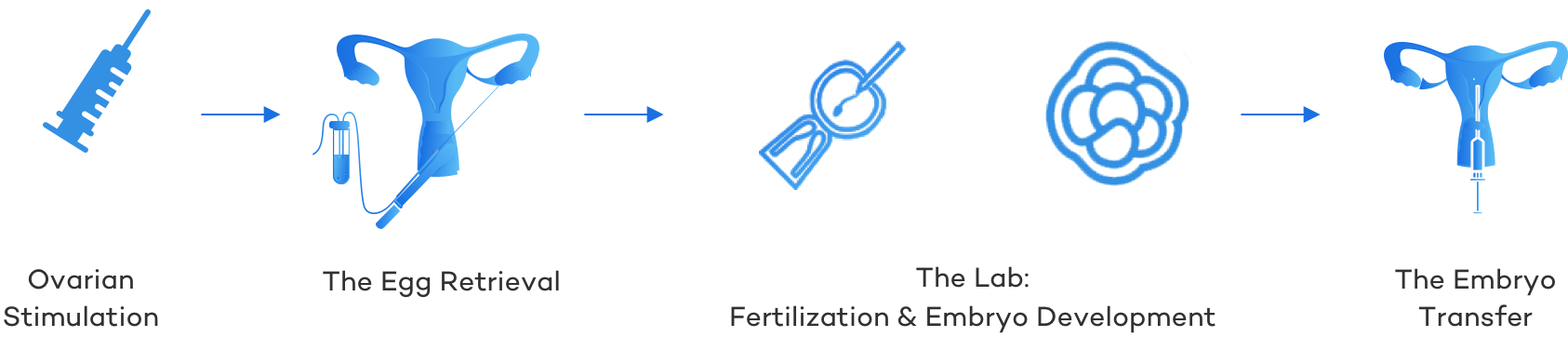 IVF Process Overview