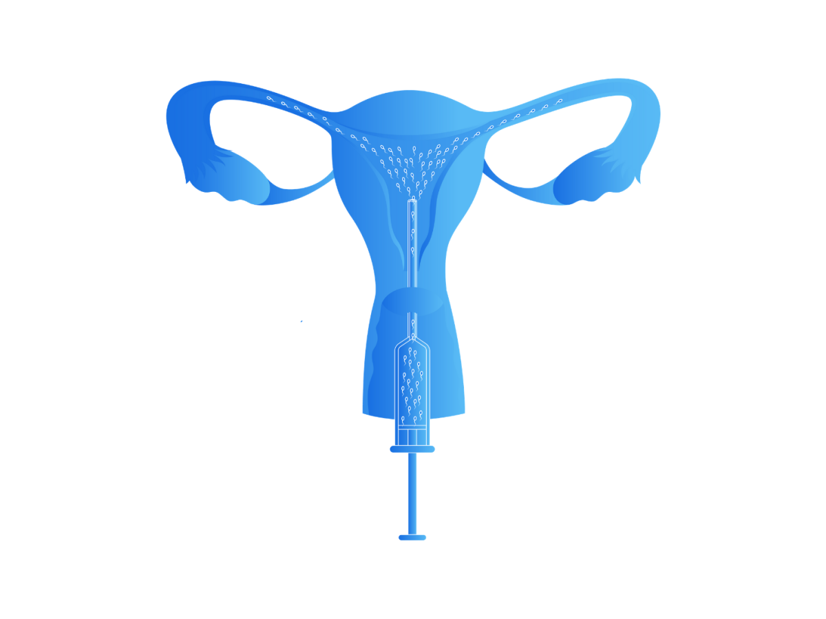 Artificial Insemination: Types, Process, Costs and More